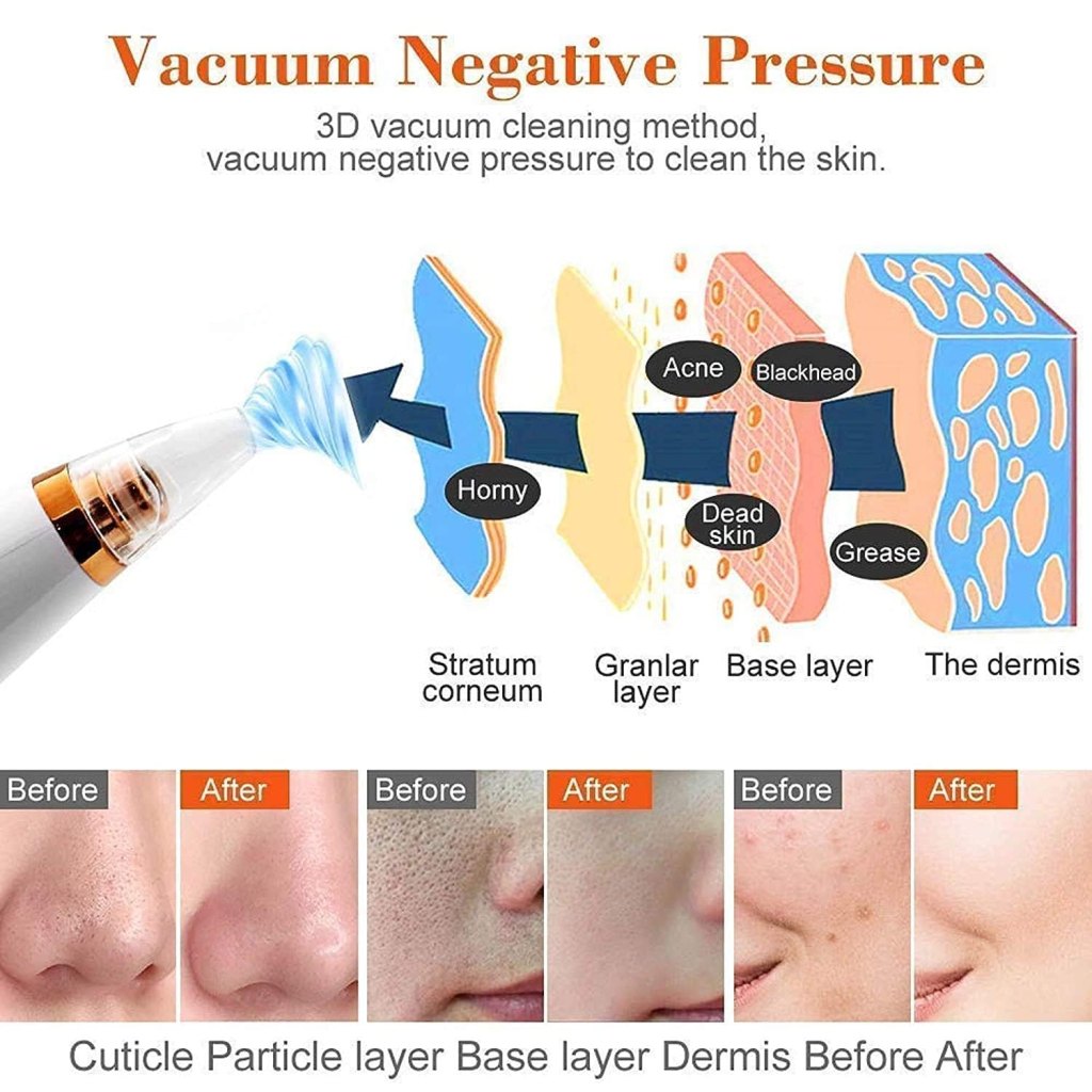 6 in 1 USB Rechargeable Blackhead Remover Pore Vacuum